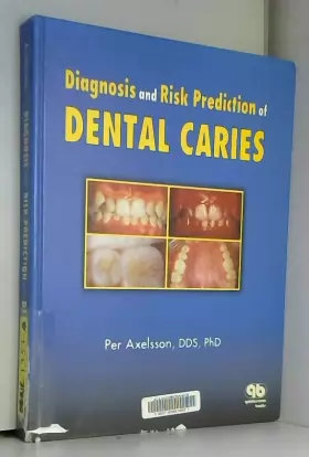 Couverture du produit · Diagnosis and Risk Prediction of Dental Caries