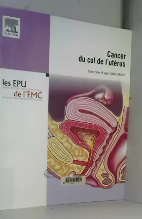 Couverture du produit · Cancer du Col de l'Utérus