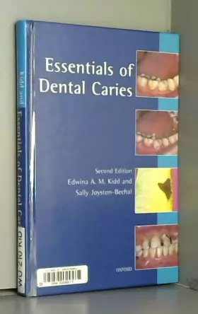 Couverture du produit · Essentials of Dental Caries: The Disease and Its Management