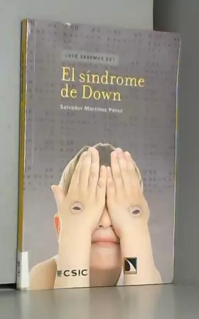 Couverture du produit · El síndrome de Down