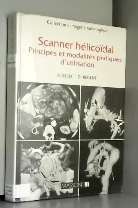Couverture du produit · Scanner helico?dal: Nouveaux principes scanographiques, applications cliniques