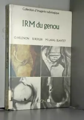 Couverture du produit · IRM du genou