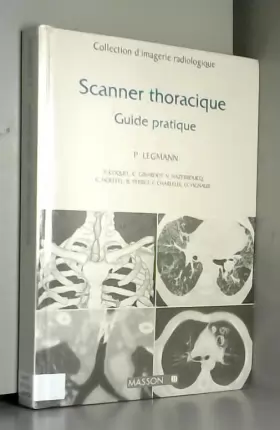 Couverture du produit · Scanner thoracique: Guide pratique