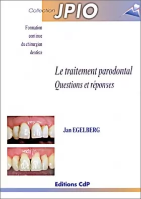 Couverture du produit · Le traitement parodontal : Questions et réponses