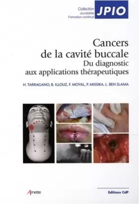 Couverture du produit · Cancers de la cavité buccale: Du diagnostic aux applications thérapeutiques
