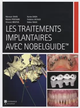 Couverture du produit · Les traitements implantaires avec Nobelguide