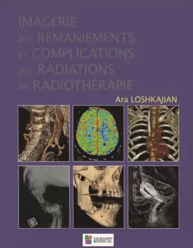 Couverture du produit · Imagerie des remaniements et complications des radiations en radiothérapie