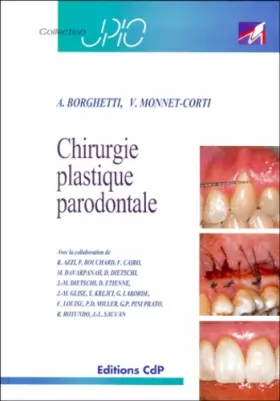 Couverture du produit · Chirurgie plastique parodontale