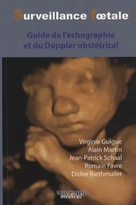 Couverture du produit · Surveillance foetale: Guide de l'échographie et du Doppler obstétrical