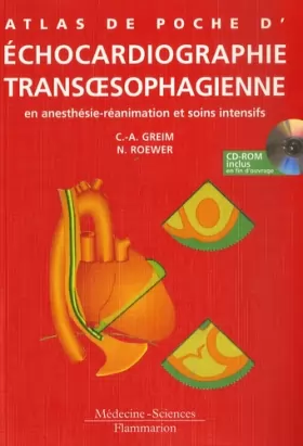 Couverture du produit · Echocardiographie transoephagienne: En anesthésie-réanimation et soins intensifs