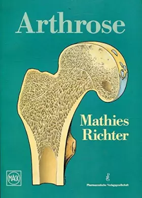 Couverture du produit · Arthrose am Beispiel des Hüftgelenkes