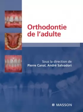 Couverture du produit · Orthodontie de l¿adulte: Rôle de l'orthodontie dans la réhabilitation générale de l'adulte