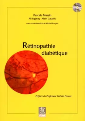 Couverture du produit · Rétinopathie diabétique. : Avec CD-Rom