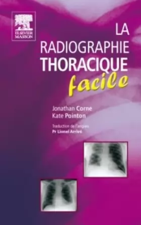 Couverture du produit · La radiographie thoracique facile