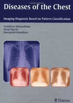 Couverture du produit · Diseases of the Chest: Imaging Diagnosis Based on Pattern Classification