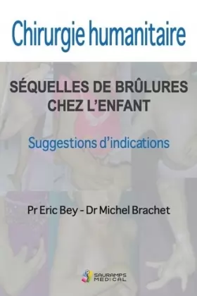 Couverture du produit · CHIRURGIE HUMANITAIRE. SEQUELLES DE BRULURES CHEZ L ENFANT: SUGESSIONS D INDICATIONS
