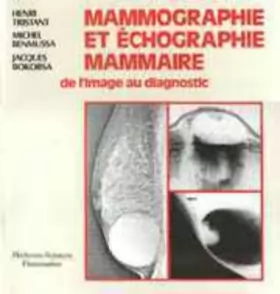 Couverture du produit · Mammographie et échographie mammaire: De l'image au diagnostic