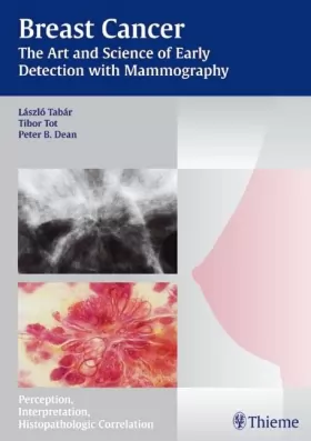 Couverture du produit · Breast Cancer: The Art and Science of Early Detection With Mammography: Perception, Interpretation, Histopathologic Correlation