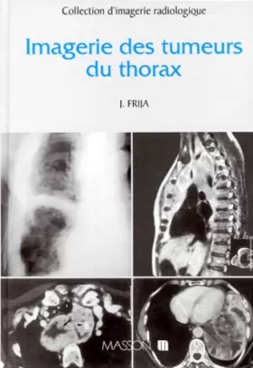 Couverture du produit · Imagerie des tumeurs du thorax