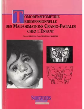 Couverture du produit · Tomodensitometrie tridimensionnelle des malformations cranio faciales de l enfant