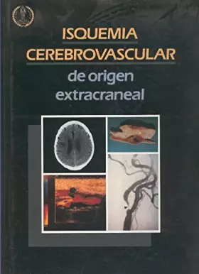 Couverture du produit · Isquemia cerebrovascular de origen extracraneal
