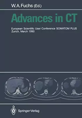 Couverture du produit · Advances in CT: European Scientific User Conference Somatom Plus Zurich, March 1990