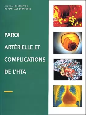 Couverture du produit · Paroi artérielle et complications de l'HTA