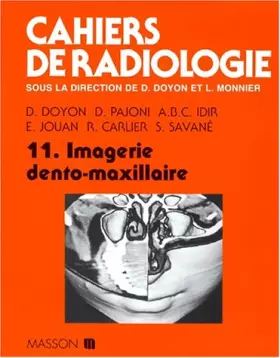 Couverture du produit · Cahiers de radiologie, numéro 11. Imagerie dento-maxillaire