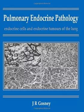Couverture du produit · Pulmonary Endocrine Pathology: Endocrine Cells and Endocrine Tumours of the Lung