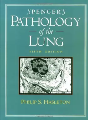 Couverture du produit · Spencer's Pathology of the Lung