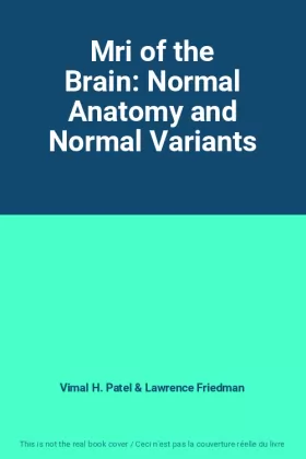 Couverture du produit · Mri of the Brain: Normal Anatomy and Normal Variants