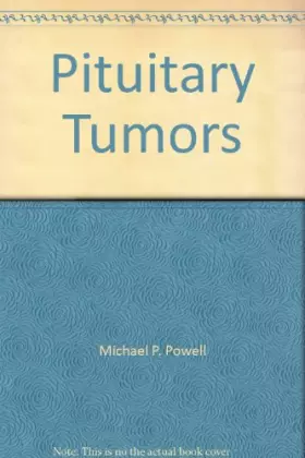 Couverture du produit · Management of Pituitary Tumours: A Handbook