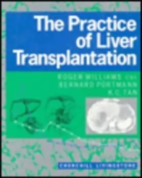Couverture du produit · The Practice of Liver Transplantation