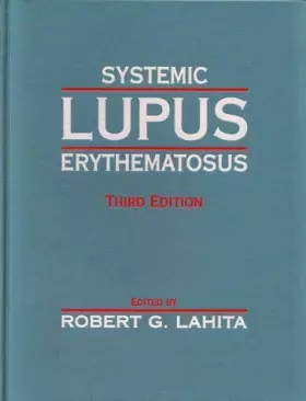 Couverture du produit · Systemic Lupus Erythematosus