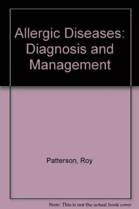 Couverture du produit · Allergic Diseases: Diagnosis and Management