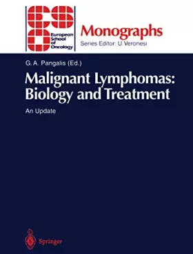 Couverture du produit · Malignant Lymphomas: Biology and Treatment : An Update