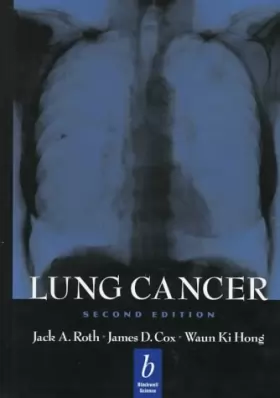 Couverture du produit · Lung Cancer