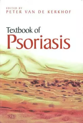 Couverture du produit · Textbook of Psoriasis