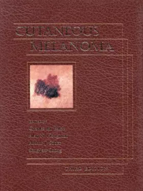 Couverture du produit · Cutaneous Melanoma