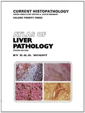 Couverture du produit · Atlas of Liver Pathology