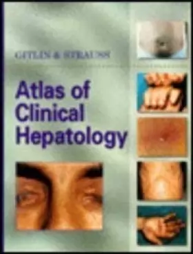 Couverture du produit · Atlas of Clinical Hepatology