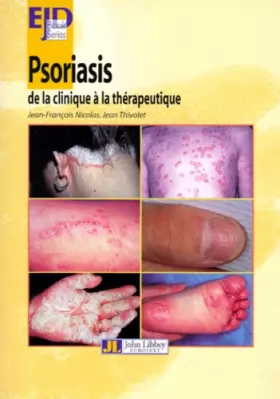 Couverture du produit · Psoriasis : De la clinique à la thérapeutique