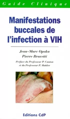 Couverture du produit · Manifestations buccales de l'infection a VIH
