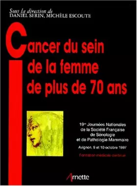 Couverture du produit · Cancer du sein de la femme de plus de 70 ans