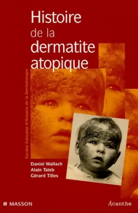 Couverture du produit · Histoire de la dermatite atopique