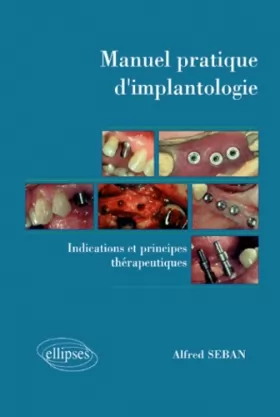 Couverture du produit · Manuel pratique d'implantologie : Indications et principes thérapeutiques