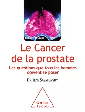Couverture du produit · Le Cancer de la prostate: Les questions que tous les hommes doivent se poser
