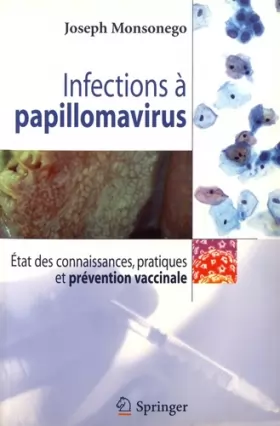 Couverture du produit · Infections a papillomavirus. : Etude des connaissances, pratiques et prevention vaccinale