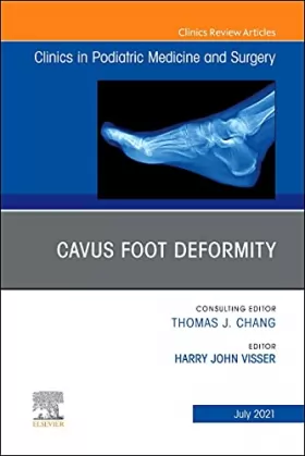 Couverture du produit · Cavus Foot Deformity: An Issue of Clinics in Podiatric Medicine and Surgery