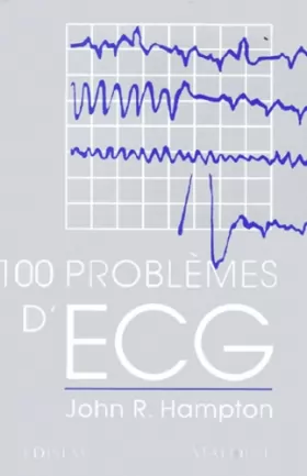 Couverture du produit · 100 problèmes d'ECG
